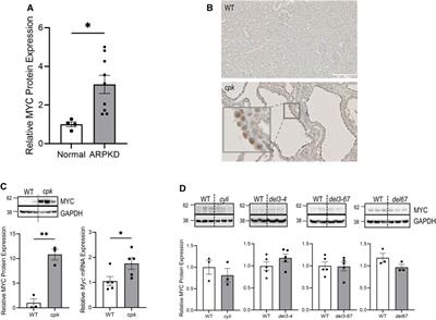 Differential regulation of MYC expression by PKHD1/Pkhd1 in human and mouse kidneys: phenotypic implications for recessive polycystic kidney disease